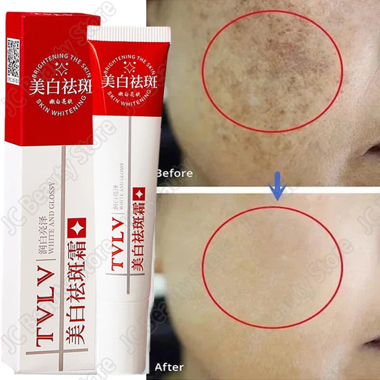 Whitening Freckle Cream Melasma Dark Spots Pigmentation Removal Products Fade Stain Melanin Repair Brighten Korean Skin Care - AdrenalineZone