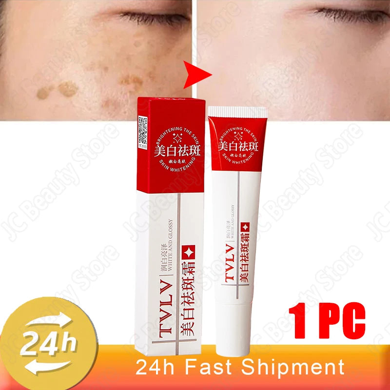 Whitening Freckle Cream Melasma Dark Spots Pigmentation Removal Products Fade Stain Melanin Repair Brighten Korean Skin Care - AdrenalineZone