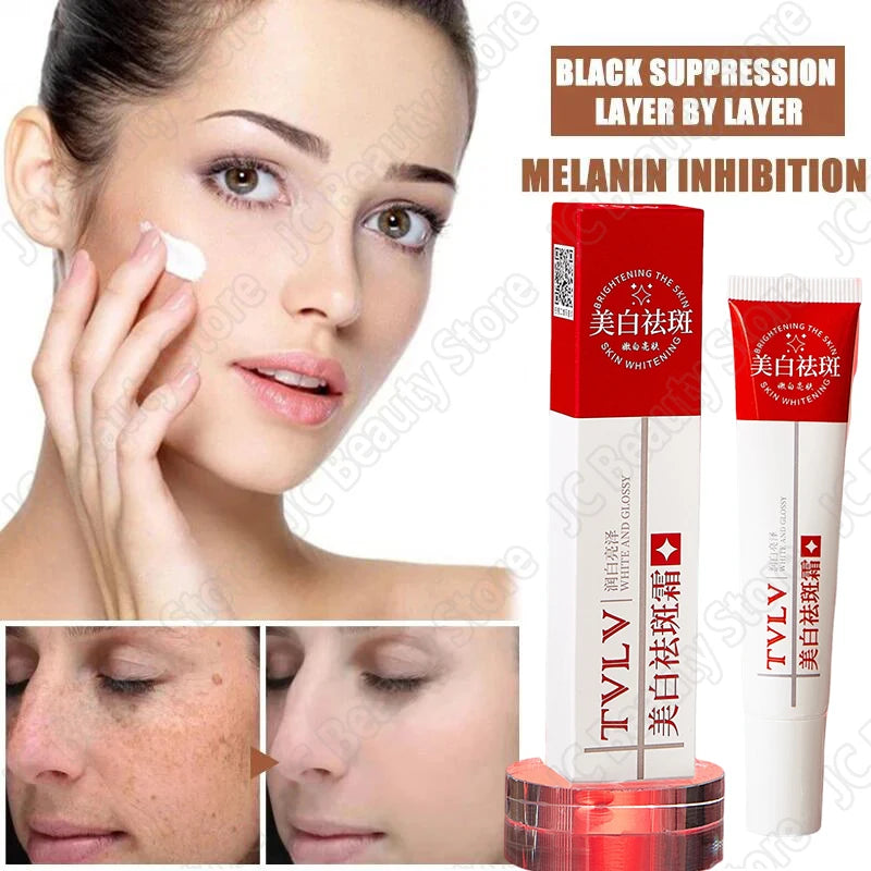 Whitening Freckle Cream Melasma Dark Spots Pigmentation Removal Products Fade Stain Melanin Repair Brighten Korean Skin Care - AdrenalineZone